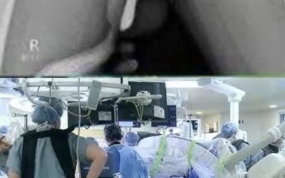 Nouvelles HT14. Une jeune fille a dû être hospitalisée pour avoir voulu utiliser un…Voir plus