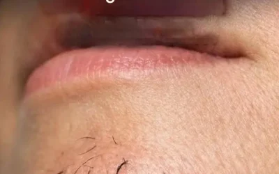 Comment le stress et l’alimentation influencent la pousse des poils du menton chez les femmes