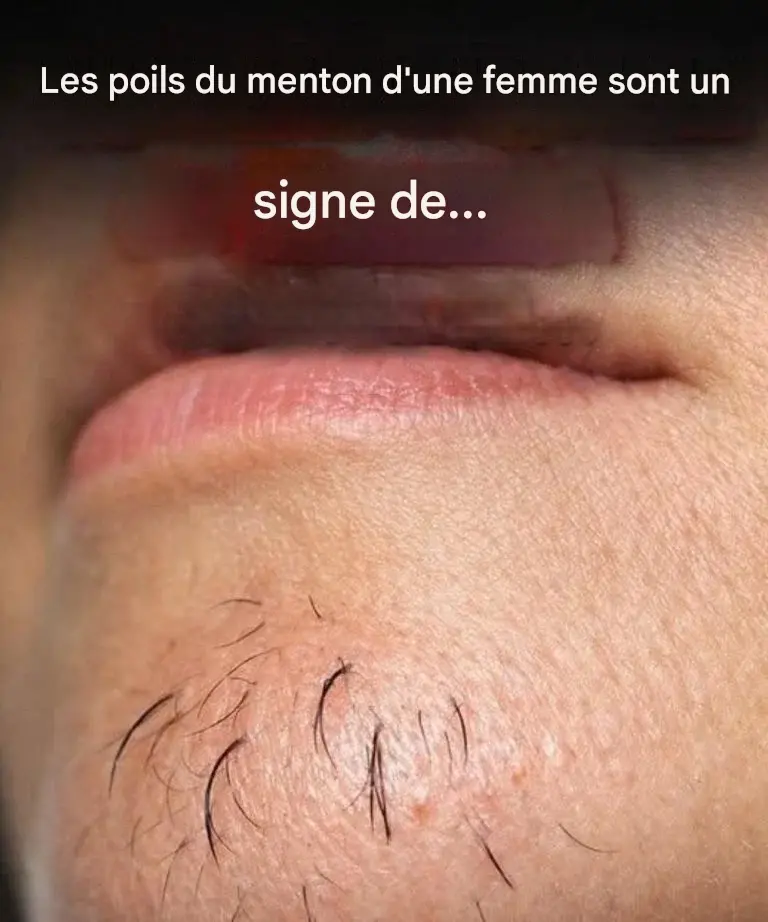 Comment le stress et l’alimentation influencent la pousse des poils du menton chez les femmes