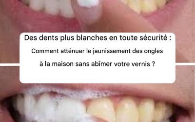 Blanchir ses dents en toute sécurité : comment atténuer le jaunissement des dents à la maison sans abîmer l’émail