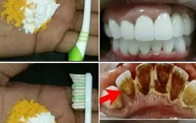 Blanchiment dentaire à domicile : obtenez des dents plus blanches en seulement 2 minutes !