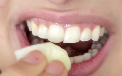 Une Fille a Trouvé une Astuce Pour Blanchir ses Dents en 2 Min