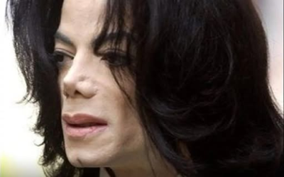 Michael Jackson : Qu’est-ce que le vitiligo, la maladie qui a touché le Roi de la Pop ?