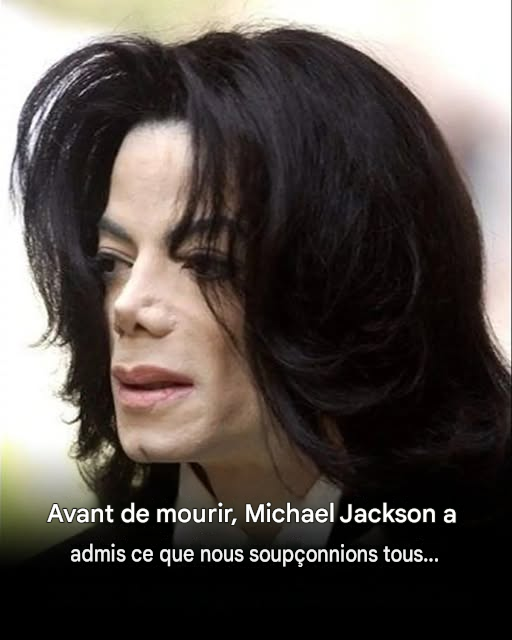 Michael Jackson : Qu’est-ce que le vitiligo, la maladie qui a touché le Roi de la Pop ?
