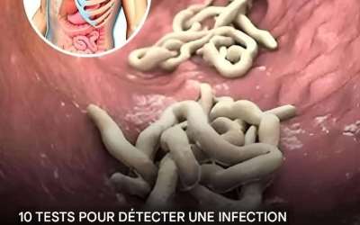 10 signes que votre corps est infesté de parasites