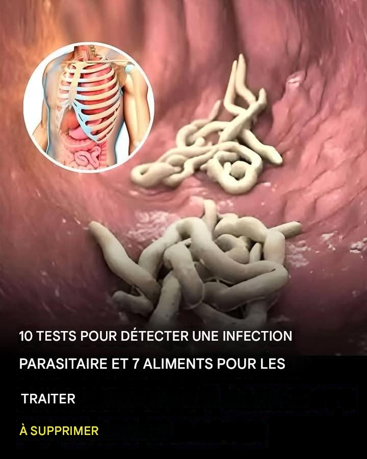 10 signes que votre corps est infesté de parasites